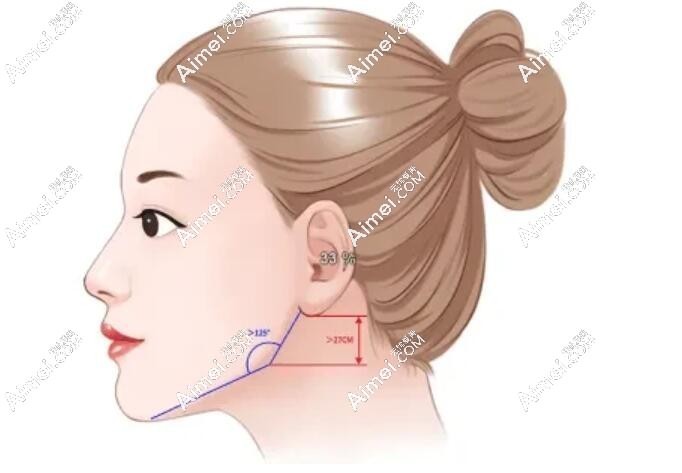 下颌角整形图片dlren.com 下颌角整形图片dlren.com
