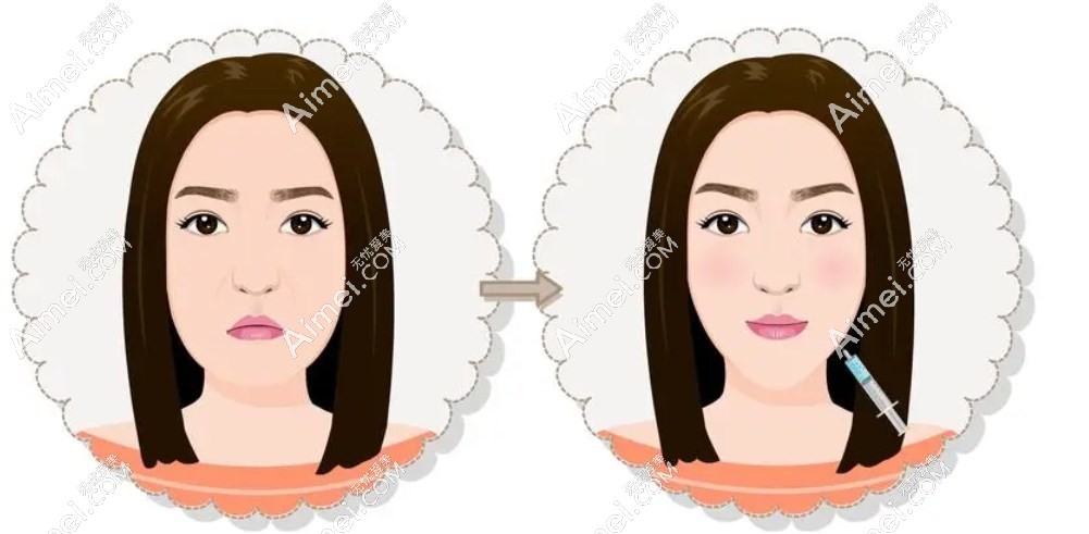 艺星幼态脸打造成效好 m.dlren.com 艺星幼态脸打造成效好 m.dlren.com