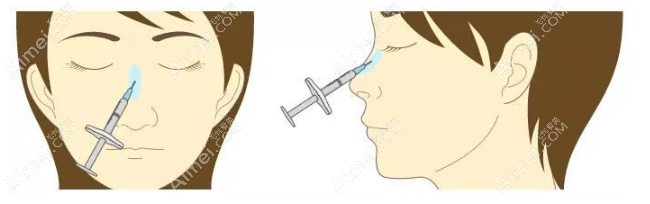 杭州连天美的戴柳丽院长注射爱贝芙实例多
