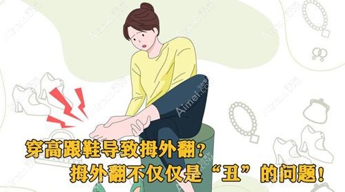北京圣嘉新足雕靠谱，苏敬达专有微孔祛大脚骨有效祛骨突+复位关节+不留疤痕