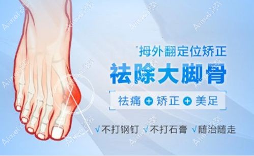 圣嘉新足雕技术靠谱 圣嘉新足雕技术靠谱