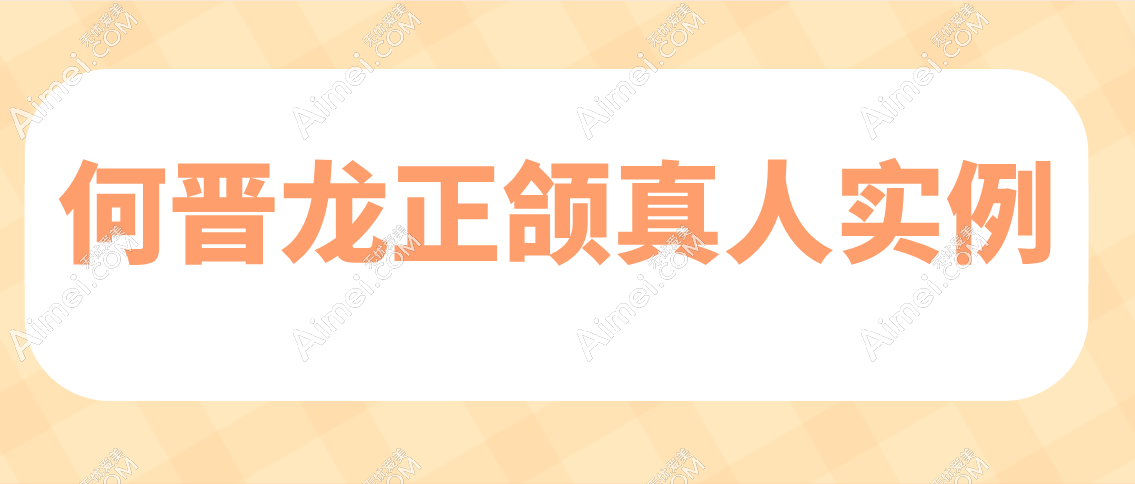 何晋龙正颌真人实例分享