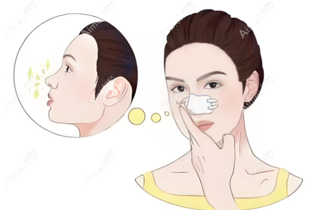 鼻整形手术www.dlren.com 鼻整形手术www.dlren.com