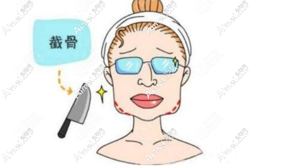 李运峰磨骨三件套多少钱-(新版价格表出炉)颧骨内推+下颌角削骨+下巴手术8万元起