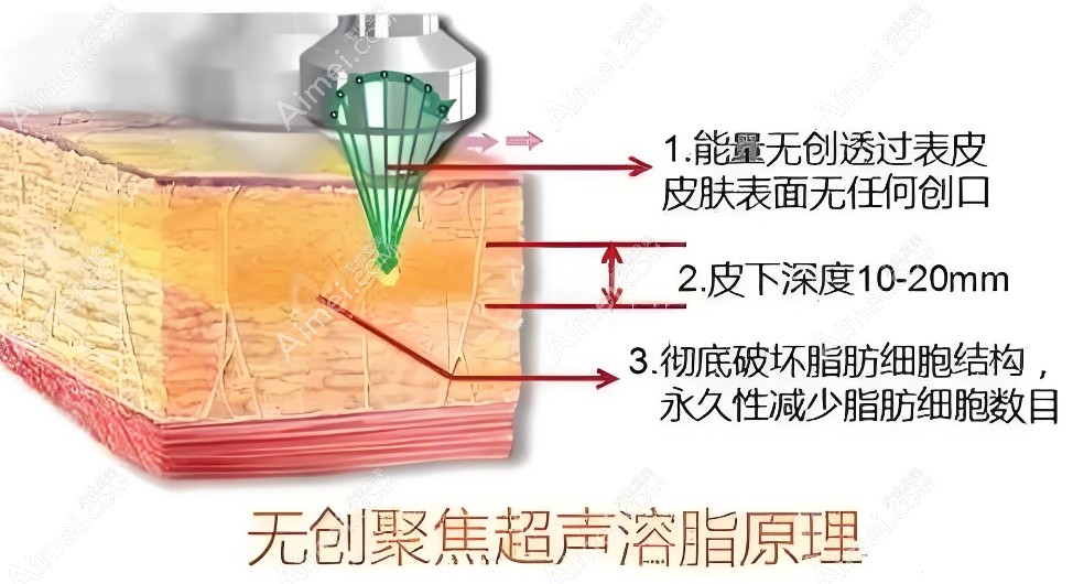 北京孙波舒适吸脂价格收费www.dlren.com