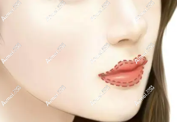 郑永生医生眼鼻嘴整形技术好 郑永生医生眼鼻嘴整形技术好