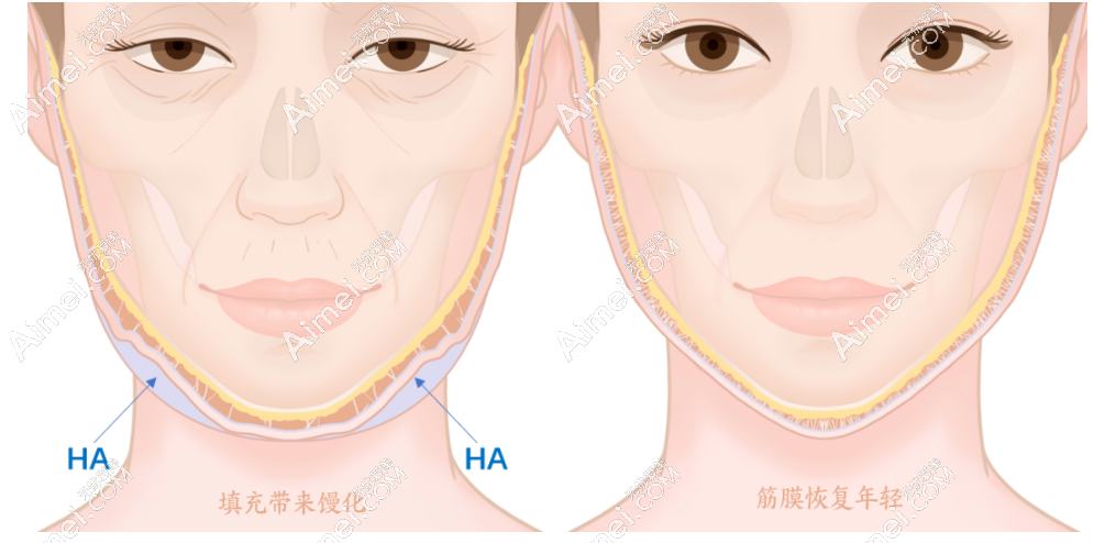 馒化脸修复哪家医院好? 馒化脸修复哪家医院好?