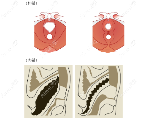 阴道紧缩治疗www.dlren.com 阴道紧缩治疗www.dlren.com