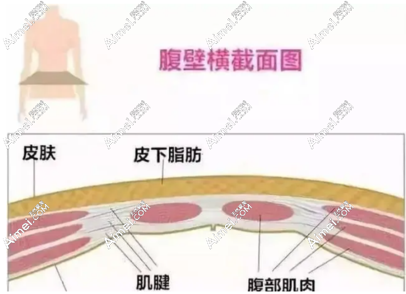 dlren.com腹壁成形手术