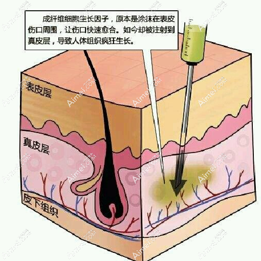 周云超做生长因子取出的技术优势 周云超做生长因子取出的技术优势