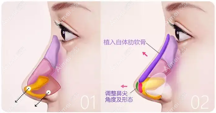 成都鼻部整形前十医院优势介绍