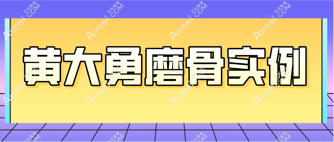 黄大勇磨骨实例分享 黄大勇磨骨实例分享