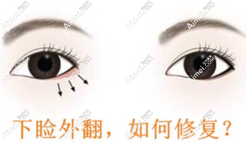 贺洁修复下眼睑怎么样?修复技术好,现坐诊于郑州东方整形医院