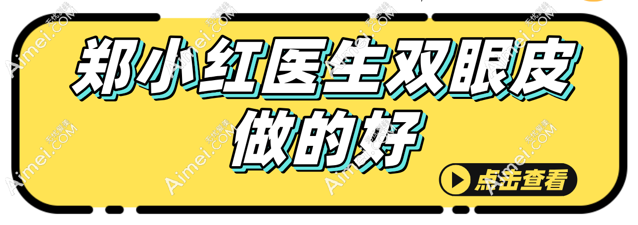 郑小红医生双眼皮做的好呀!做初眼及双眼皮修复至今都没失败实例