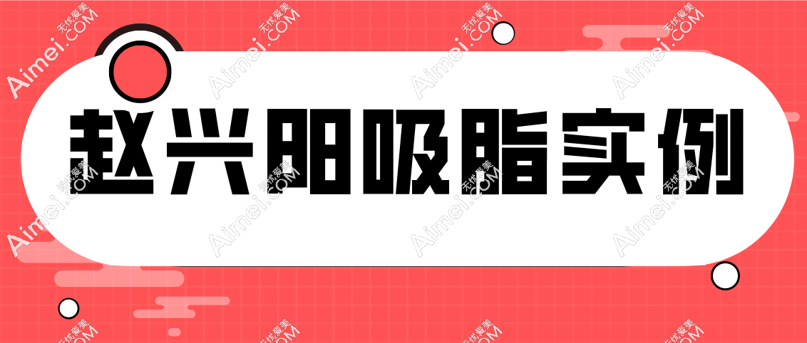 赵兴阳吸脂实例 赵兴阳吸脂实例