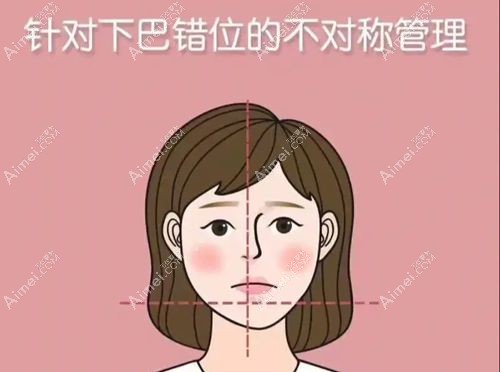 成都李继华磨骨怎么样？面诊发现李继华磨骨前后对比明显尤其做正颌手术成功实例很多