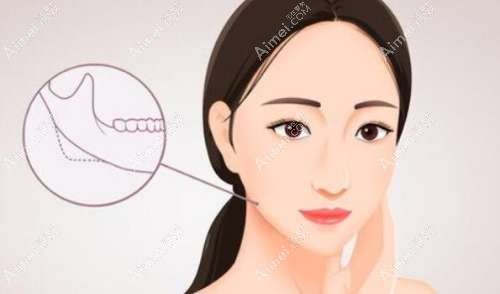 李继华磨骨手术前后对比明显 李继华磨骨手术前后对比明显