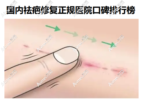 国内祛疤痕修复医院排行榜 国内祛疤痕修复医院排行榜