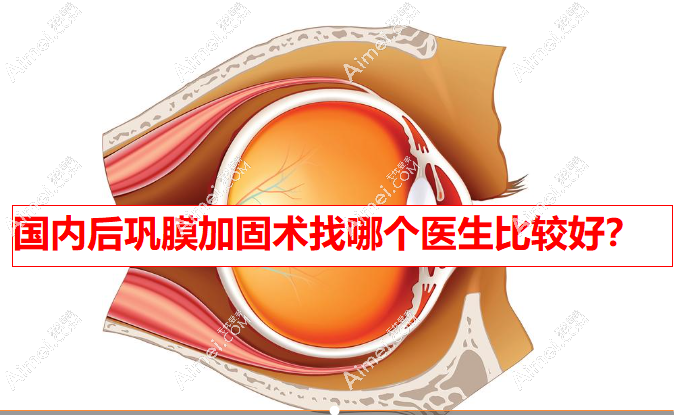 2025国内后巩膜加固术找哪个医生比较好?公认技术排名前10医生已敲定,无争议