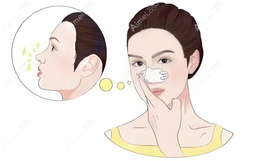 福州鼻修复做得好的医生排名前八 福州鼻修复做得好的医生排名前八