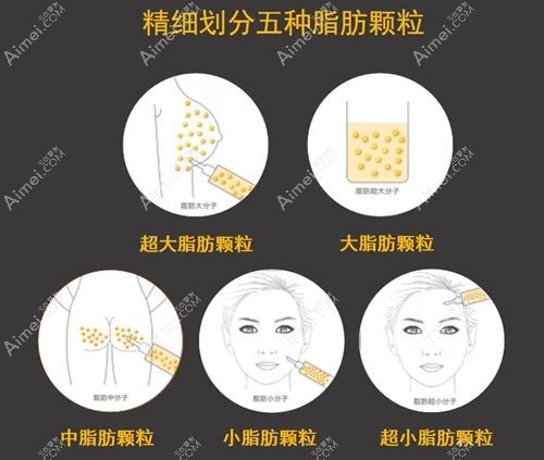 国内自体脂肪隆胸医生排行榜 国内自体脂肪隆胸医生排行榜