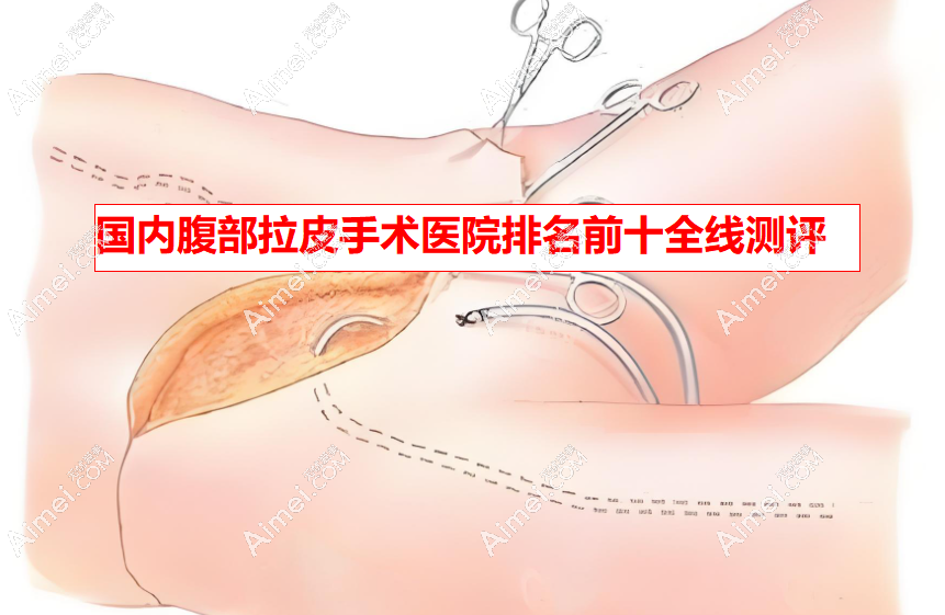 2025国内腹部拉皮手术医院排名前十全线测评_北京华韩/西安国医可以放心选