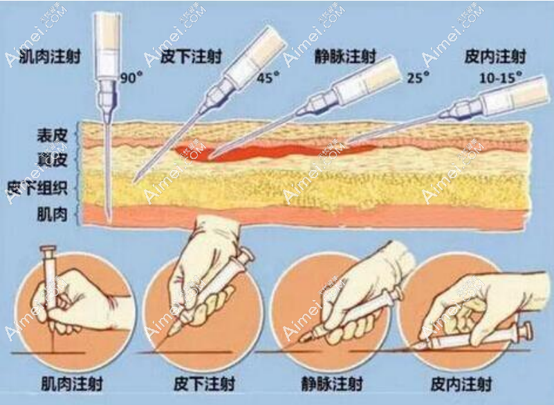 dlren.com上海薇琳医疗美容医院注射