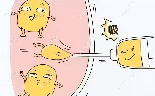 2025佛山面部精细吸脂医院排名to8:顺德广大|壹加壹面部吸脂排名前二可以闭眼入 