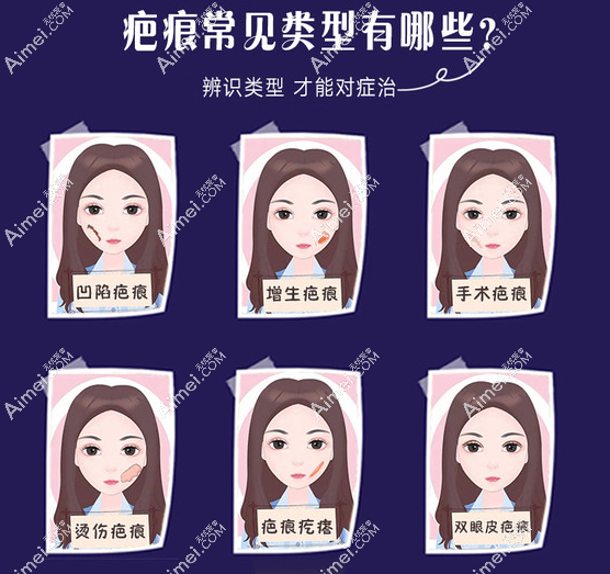 北京特色疤痕修复医院哪家好 北京特色疤痕修复医院哪家好