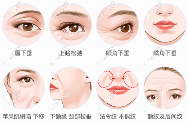 北京拉皮特色整形医院哪家好 北京拉皮特色整形医院哪家好