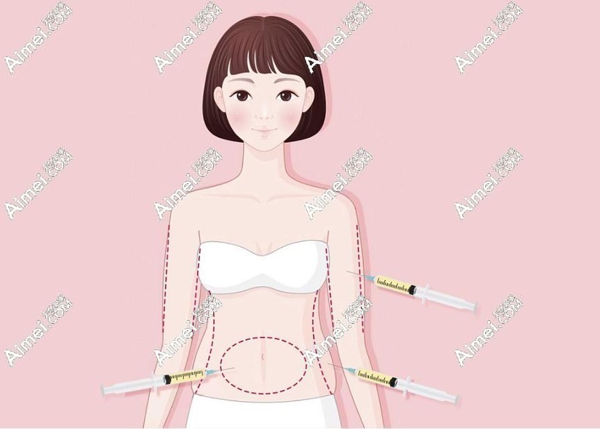 王自谦吸脂价格 王自谦吸脂价格