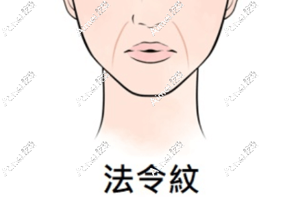2025法令纹医美去除方法:拉皮/热玛吉/玻尿酸/埋线提升都有成效,怎么选看这! 2025法令纹医美去除方法:拉皮/热玛吉/玻尿酸/埋线提升都有成效,怎么选看这!