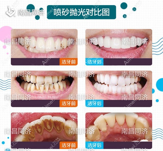 南昌同济医院口腔科 南昌同济医院口腔科