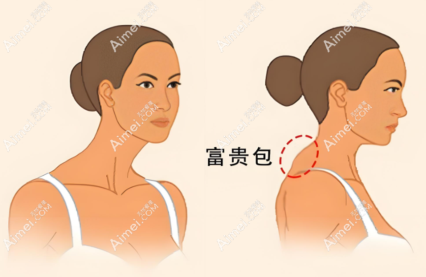 黄学峰医生富贵包预约联系方式获取www.dlren.com 黄学峰医生富贵包预约联系方式获取www.dlren.com