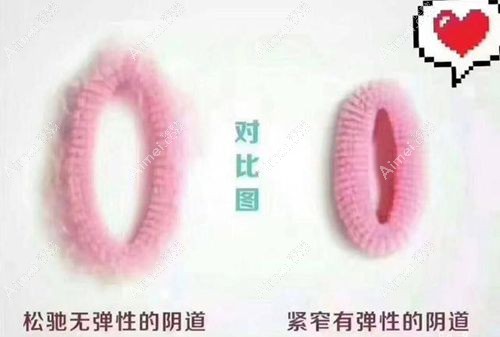 紧缩针哪里可以打 紧缩针哪里可以打