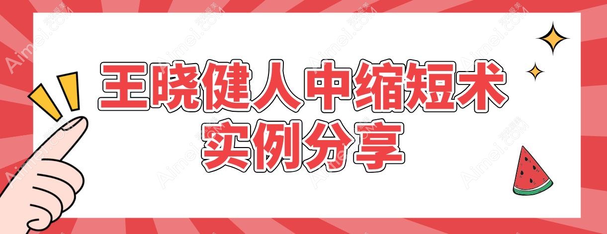 王晓健人中缩短术实例分享 王晓健人中缩短术实例分享