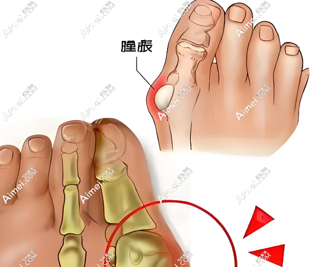 马桂文医生现在哪家医院?得去朝阳西坝河南路找他(大脚骨微创技术好收费均价35800元)