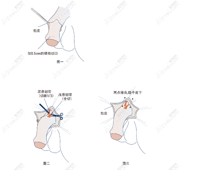 李世荣生殖整形价格 李世荣生殖整形价格