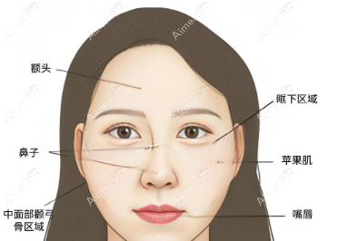 钟杰光治疗费用坑吗? 钟杰光治疗费用坑吗?