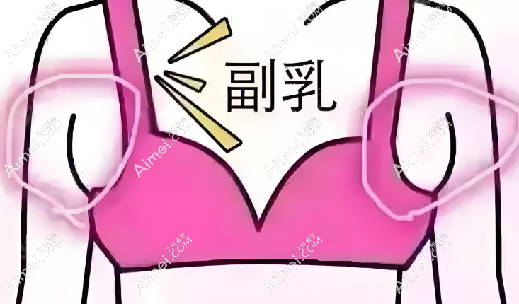 八大处穆大力切副乳疤痕小修复快,是国内排名前三的副乳切除医生,技术超绝! 八大处穆大力切副乳疤痕小修复快,是国内排名前三的副乳切除医生,技术超绝!