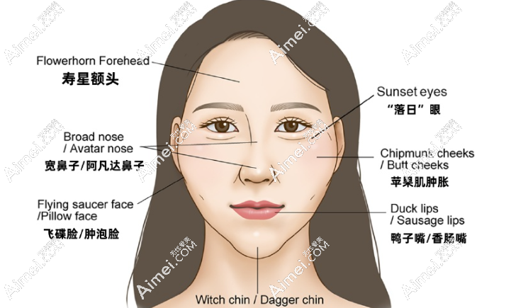 什么是馒化脸 什么是馒化脸