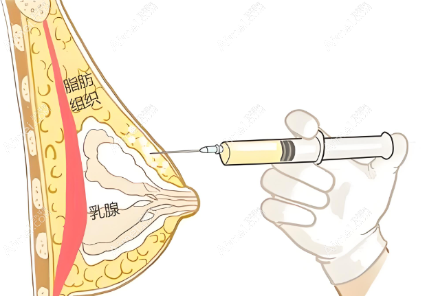 北京项力源丰胸怎么样www.dlren.com 北京项力源丰胸怎么样www.dlren.com