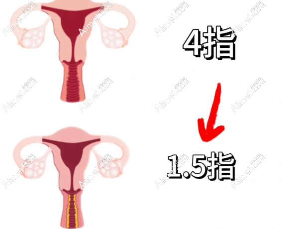 温州有紧缩针的医院:粉范|艺星等七家医院有私密紧缩针,收费透明速来预约！   m.dlren.com