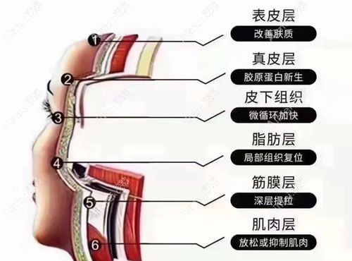 全脸做美拉美超声刀10000元起一次,比热玛吉做全脸29800元便宜但提升成效不打折