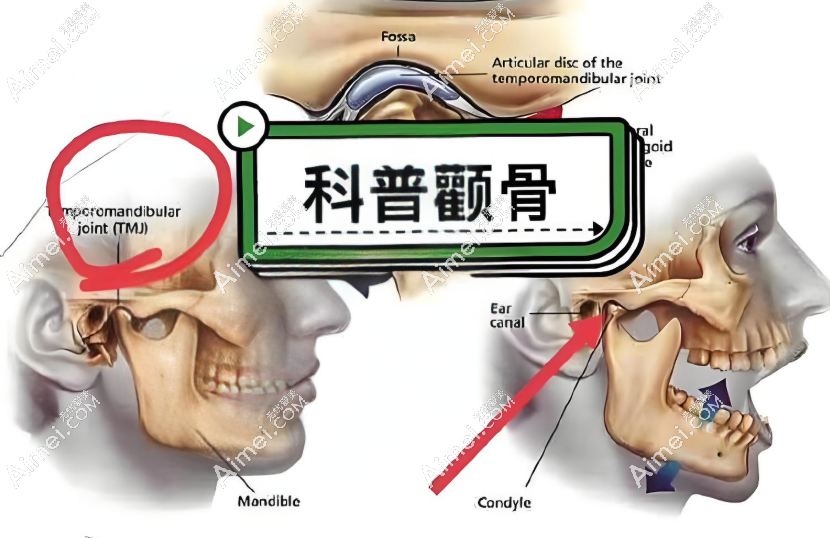 颧弓结构 颧弓结构