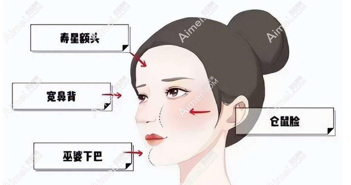脂肪整形及修复医生王东技术好