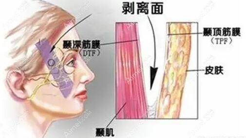 2025国内做面部筋膜悬吊提升好的医院top30家推荐：北京加减美实力强位居前列