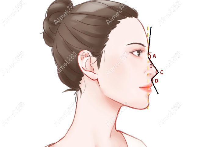 徐利刚美鼻打造真实实例www.dlren.com 徐利刚美鼻打造真实实例www.dlren.com