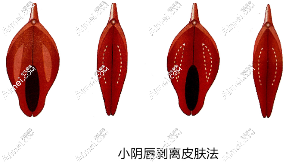 20241125643893.png image.png
