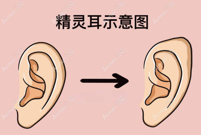 八大处李川简历一览(网红都找他做精灵耳,好看且收费不贵)微信挂号预约本人超快 八大处李川简历一览(网红都找他做精灵耳,好看且收费不贵)微信挂号预约本人超快